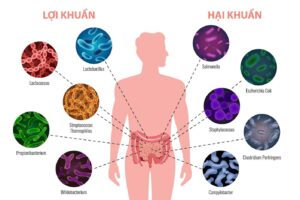 So sánh hệ vi sinh vật khỏe mạnh và mất cân bằng ảnh hưởng đến bệnh gút